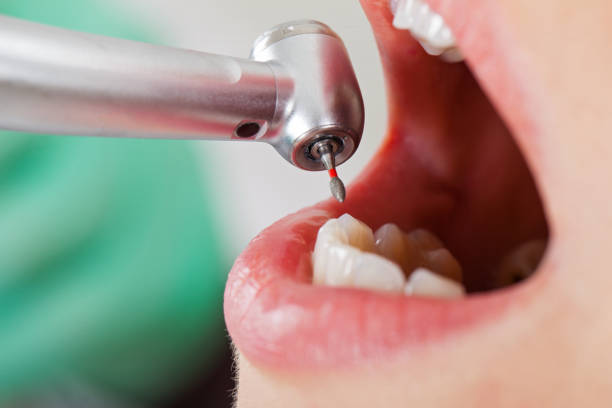 Best Urgent Care for Lost Fillings or Crowns in Point Pleasant, WV